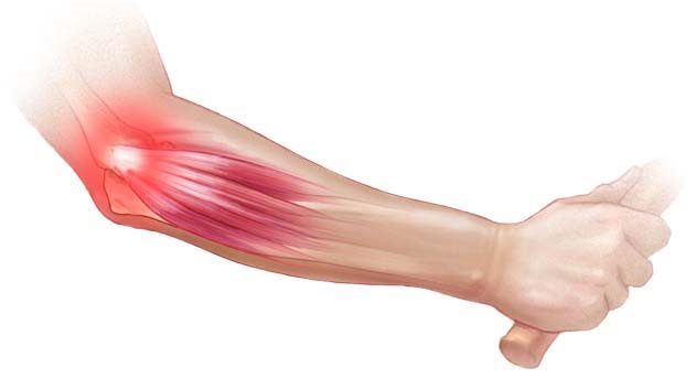 peesontsteking massage